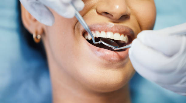 Best Emergency Gum Treatment in Hershey, PA
