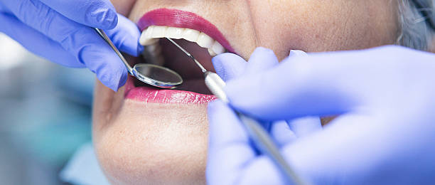 Best Same-Day Emergency Dental Services in Hershey, PA